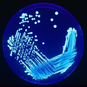 Bactérias da Legionella no microscópio / Foto Wikimedia - CC